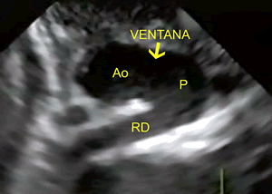 Figura 2